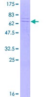 ab162839 on a 12.5% SDS-PAGE stained with Coomassie Blue.