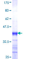 ab162840 on a 12.5% SDS-PAGE stained with Coomassie Blue.