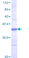 ab166362 on a 12.5% SDS-PAGE stained with Coomassie Blue.