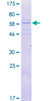 ab164173 on a 12.5% SDS-PAGE stained with Coomassie Blue.