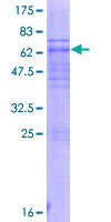 ab165606 on a 12.5% SDS-PAGE stained with Coomassie Blue.