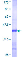 ab162736 on a 12.5% SDS-PAGE stained with Coomassie Blue.