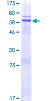 ab165893 on a 12.5% SDS-PAGE stained with Coomassie Blue.