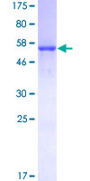 ab159889 on a 12.5% SDS-PAGE stained with Coomassie Blue.