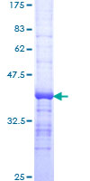 ab158296 on a 12.5% SDS-PAGE stained with Coomassie Blue.