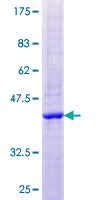 ab163687 on a 12.5% SDS-PAGE stained with Coomassie Blue.