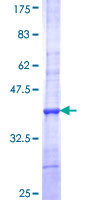 ab163688 on a 12.5% SDS-PAGE stained with Coomassie Blue.