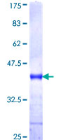 ab164917 on a 12.5% SDS-PAGE stained with Coomassie Blue.