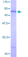 ab160033 on a 12.5% SDS-PAGE stained with Coomassie Blue.