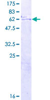 ab164161 on a 12.5% SDS-PAGE stained with Coomassie Blue.