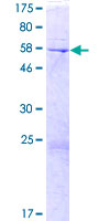 ab163187 on a 12.5% SDS-PAGE stained with Coomassie Blue.