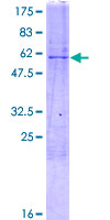 ab163241 on a 12.5% SDS-PAGE stained with Coomassie Blue.
