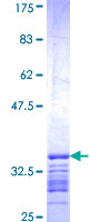 ab163242 on a 12.5% SDS-PAGE stained with Coomassie Blue.