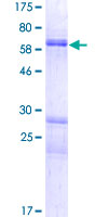 ab165951 on a 12.5% SDS-PAGE stained with Coomassie Blue.
