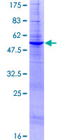 ab163511 on a 12.5% SDS-PAGE stained with Coomassie Blue.