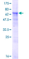 ab158302 on a 12.5% SDS-PAGE stained with Coomassie Blue.