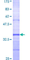 12.5% SDS-PAGE Stained with Coomassie Blue with recombinant protein.