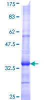 ab112352 analysed on a 12.5% SDS-PAGE gel stained with Coomassie Blue.