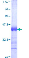 ab161828 on a 12.5% SDS-PAGE stained with Coomassie Blue.
