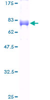 ab159685 on a 12.5% SDS-PAGE stained with Coomassie Blue.