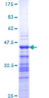 ab159686 on a 12.5% SDS-PAGE stained with Coomassie Blue.