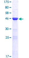 ab161835 on a 12.5% SDS-PAGE stained with Coomassie Blue.