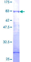 ab159327 on a 12.5% SDS-PAGE stained with Coomassie Blue.