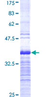 ab159328 on a 12.5% SDS-PAGE stained with Coomassie Blue.