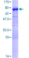 ab158306 on a 12.5% SDS-PAGE stained with Coomassie Blue.
