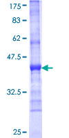 ab158307 on a 12.5% SDS-PAGE stained with Coomassie Blue.