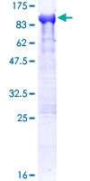 ab153043 on a 12.5% SDS-PAGE stained with Coomassie Blue.