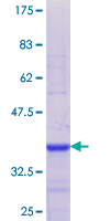 ab153044 on a 12.5% SDS-PAGE stained with Coomassie Blue.