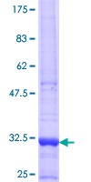 ab162873 on a 12.5% SDS-PAGE stained with Coomassie Blue.
