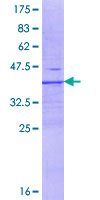 ab153568 on a 12.5% SDS-PAGE stained with Coomassie Blue.