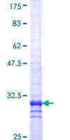 ab161701 on a 12.5% SDS-PAGE stained with Coomassie Blue.