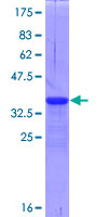ab160160 on a 12.5% SDS-PAGE stained with Coomassie Blue.