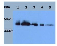 ab56518 has a calculated molecular mass of 43 kDa. As a result of glycosylation, the recombinant protein migrates approximately as a 46 kDa protein in SDS-PAGE under reducing conditions. Immunostaining with DR4 specific antibody, detection with Goat anti-mouse / HRP secondary antibody. Gel: 12%. Lane 1 : ab56518 at 0.37 µg, Lane 2 : ab56518 at 0.15 µg, Lane 3 : ab56518 at 0.075 µg, Lane 4 : ab56518 at 0.037 µg, Lane 5 : ab56518 at 0.015 µg.