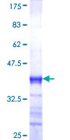 ab160486 on a 12.5% SDS-PAGE stained with Coomassie Blue.