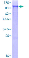ab153041 on a 12.5% SDS-PAGE stained with Coomassie Blue.