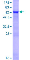ab164171 on a 12.5% SDS-PAGE stained with Coomassie Blue.