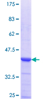ab164172 on a 12.5% SDS-PAGE stained with Coomassie Blue.