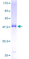 ab163177 on a 12.5% SDS-PAGE stained with Coomassie Blue.