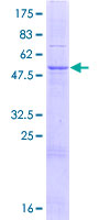 ab161628 on a 12.5% SDS-PAGE stained with Coomassie Blue.
