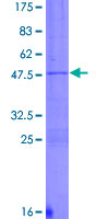 ab158297 on a 12.5% SDS-PAGE stained with Coomassie Blue.