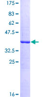 ab158298 on a 12.5% SDS-PAGE stained with Coomassie Blue.