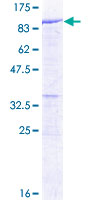 ab158300 on a 12.5% SDS-PAGE stained with Coomassie Blue.
