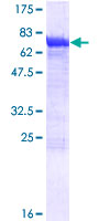 ab158301 on a 12.5% SDS-PAGE stained with Coomassie Blue.