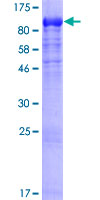 ab158299 on a 12.5% SDS-PAGE stained with Coomassie Blue.