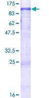 ab160359 on a 12.5% SDS-PAGE stained with Coomassie Blue.