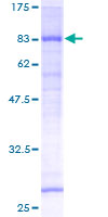 ab160031 on a 12.5% SDS-PAGE stained with Coomassie Blue.